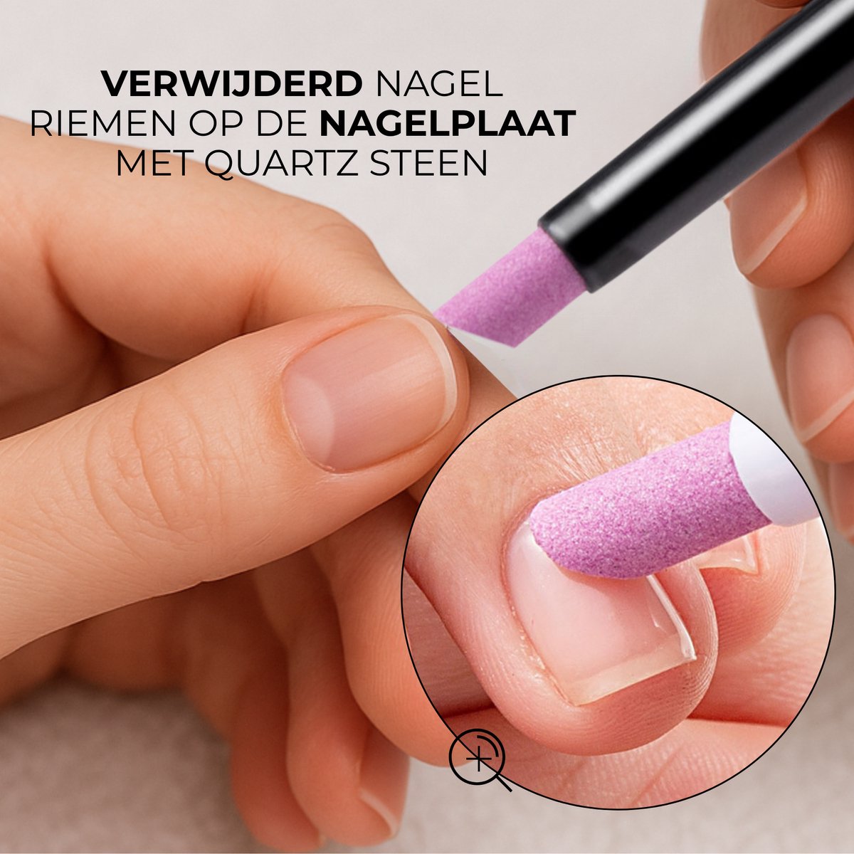 Nagelriem Verwijderaar 10 Stuks Zwart