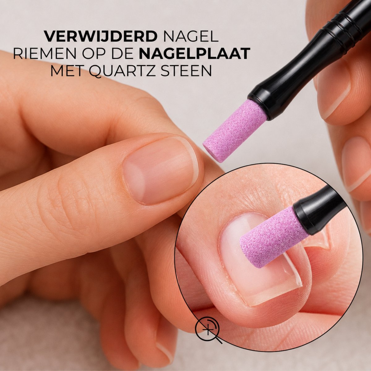 Nagelriem Verwijderaar 10 Stuks