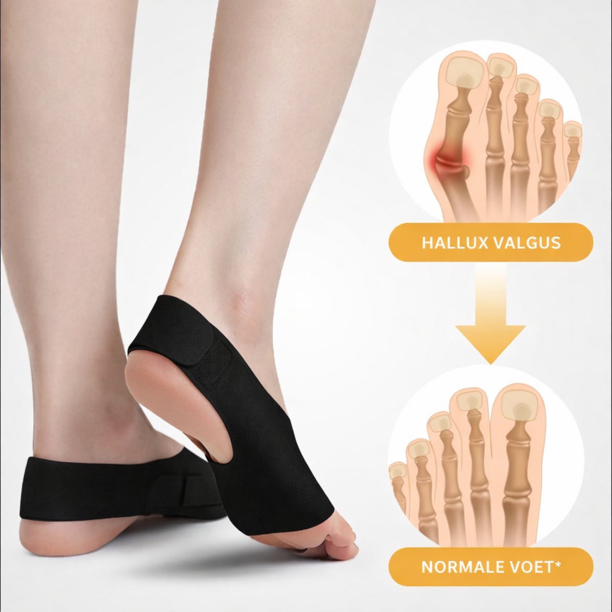 Hallux Valgus Bunion Grote Teen Spalk 2 Stuks Zwart