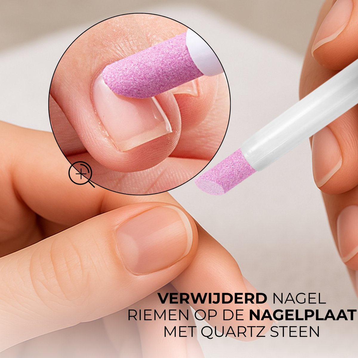 Nagelriem Verwijderaar 10 Stuks Wit