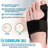 Hallux Valgus Bunion Grote Teen Spalk 2 Stuks